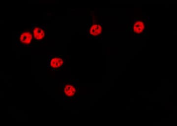 Polyclonal Rabbit anti-Human TCEAL1 Antibody (IF, WB)