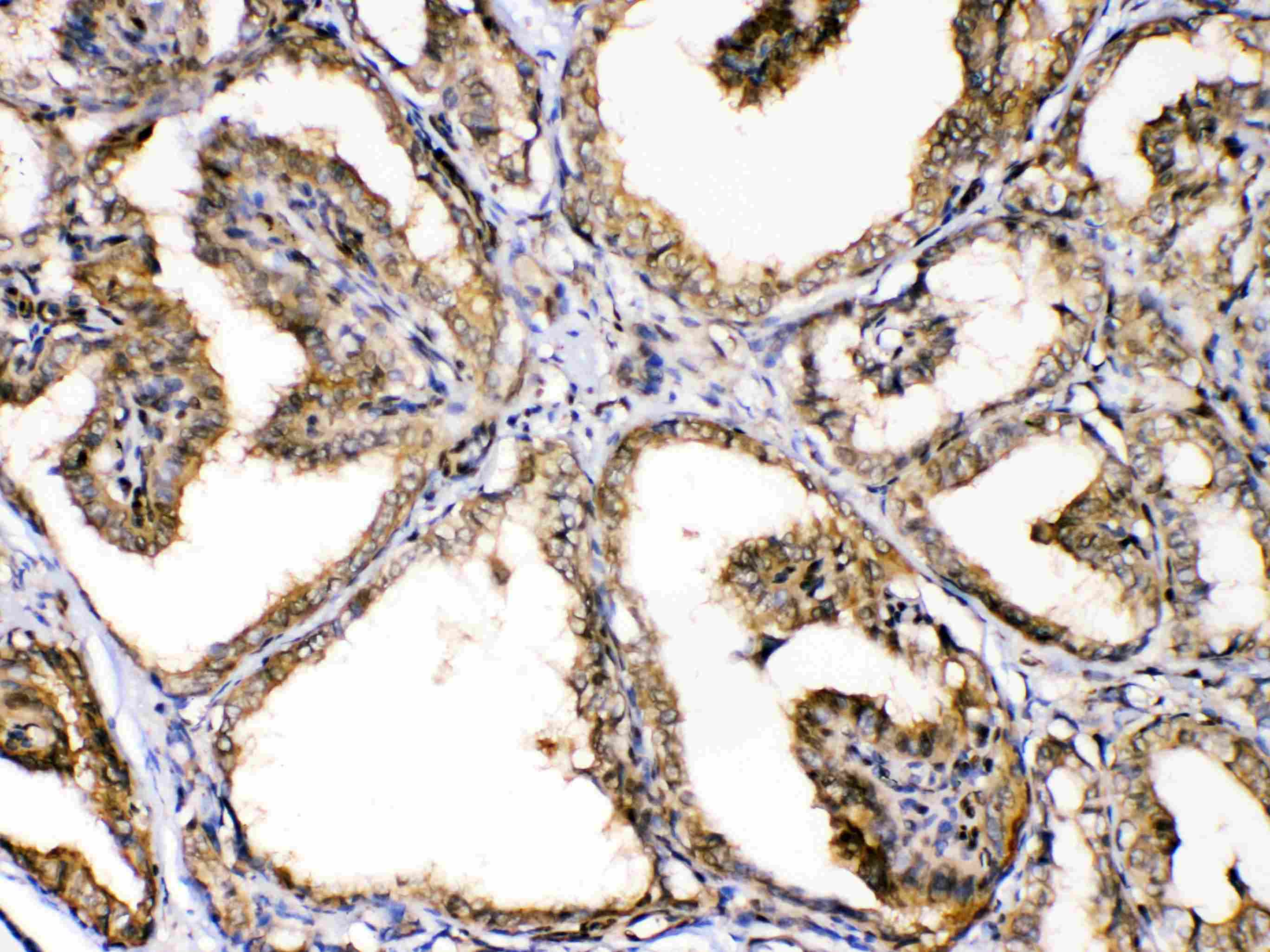 GAPDH Antibody