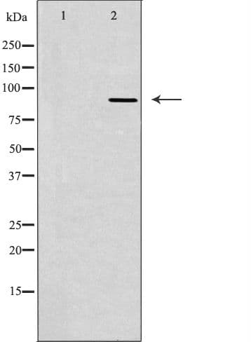 TLK2 Antibody