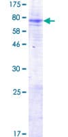 Human MBOAT7 / BB1 Protein (Recombinant GST)