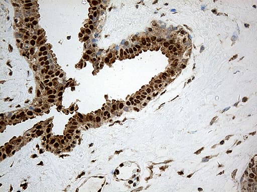CDK15 / ALS2CR7 Antibody (aa293-378, clone OTI3B9)
