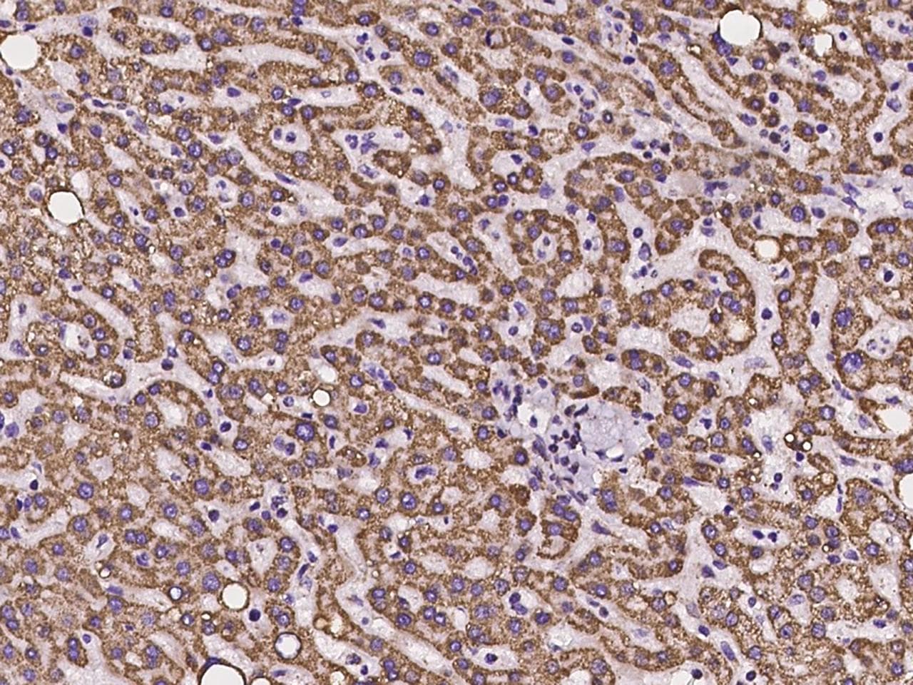 Polyclonal Rabbit anti-Human ANKRD33B Antibody (IHC, IF)