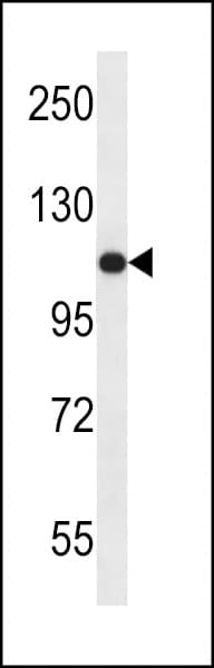 Polyclonal Rabbit anti-Human US01 / p115 Antibody (aa932-960, IHC, WB)