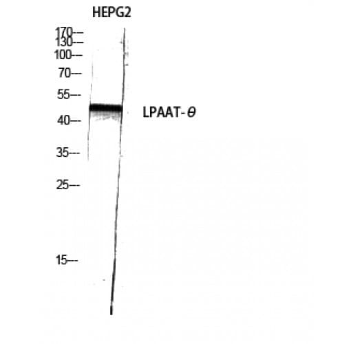 Polyclonal Rabbit anti-Human AGPAT9 / MAG1 Antibody (350-430 aa, C-terminal, IHC, IF, WB)