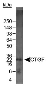 CTGF Antibody (C-Terminus, DY488)
