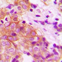 MARK2 Antibody (N-Terminus)