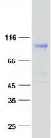 Human NDST3 Protein (Recombinant Myc-DDK (Flag))