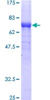Human ADSS Protein (Recombinant GST)