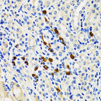 Polyclonal Rabbit anti-Human ODC1 / Ornithine Decarboxylase Antibody (IHC, WB)
