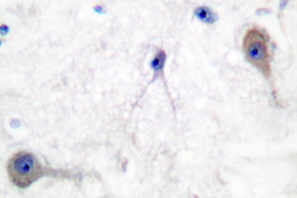 Polyclonal Rabbit anti-Human PTCH1 / Patched 1 Antibody (Ala2, IHC, WB)