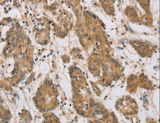 CST6 / Cystatin E/M Antibody