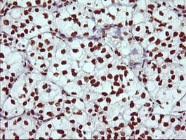 THUMPD1 Antibody (clone OTI1H6)