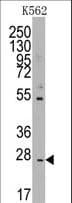CD8B / CD8 Beta Antibody (aa64-92)