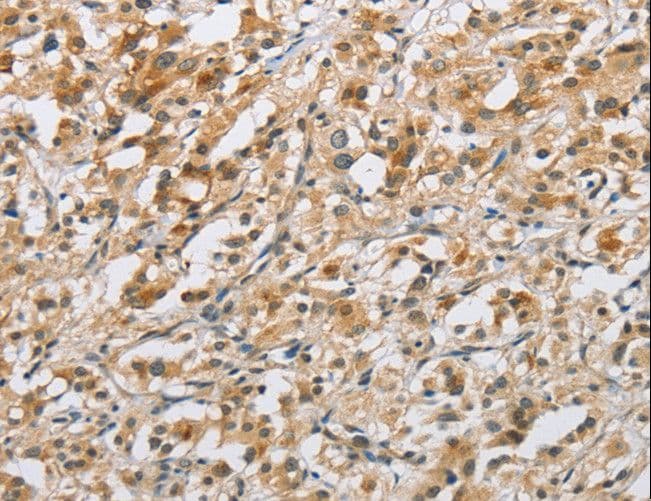 IHC-plus™ Polyclonal Rabbit anti-Human NAPSA / NAPA / Napsin A Antibody (IHC)