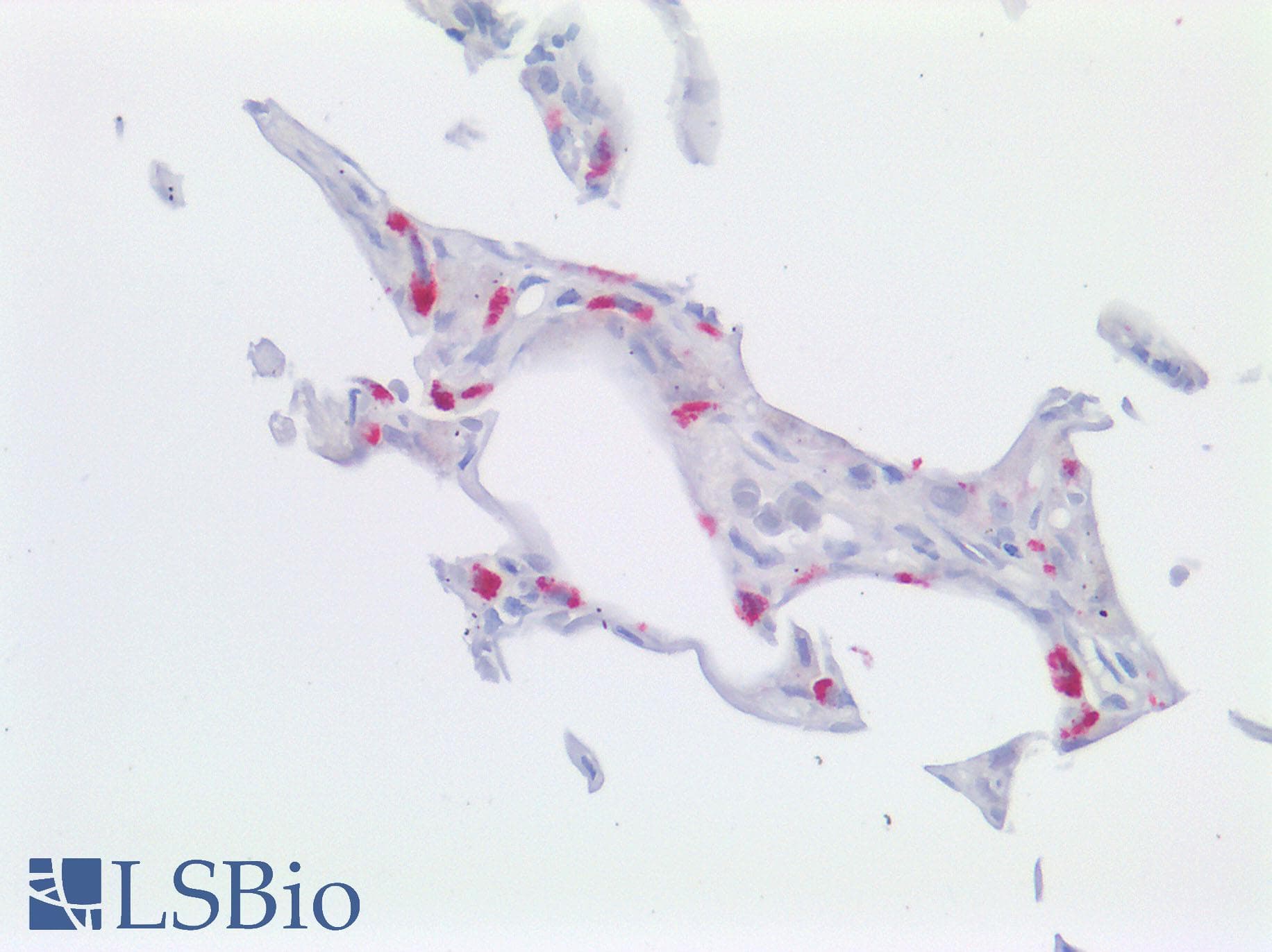 Polyclonal Rabbit anti-Human ABCA3 Antibody (aa43-203, IHC)