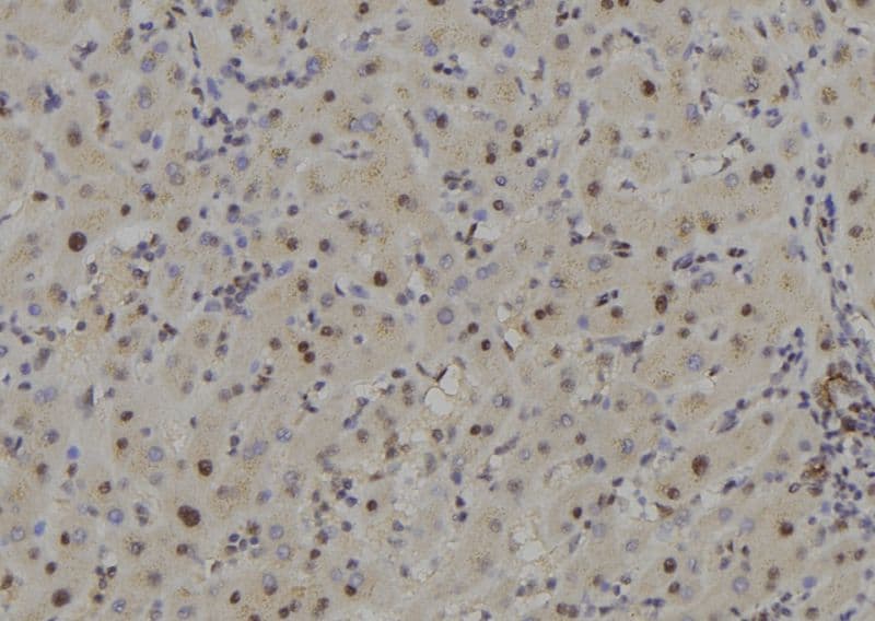 Polyclonal Rabbit anti-Human COPS7B / CSN7B Antibody (IHC, WB)