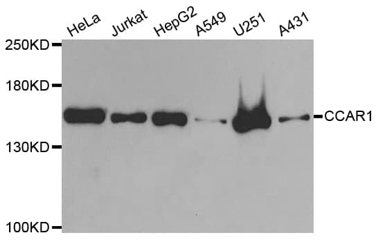 DIS / CCAR1 Antibody