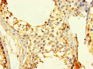 Polyclonal Rabbit anti-Human CDC25C Antibody
