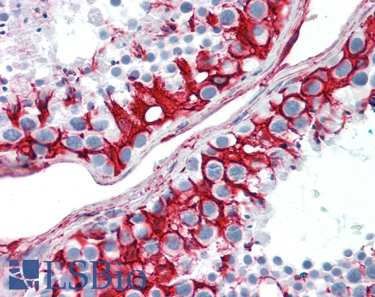 PathPlus™ Vimentin Antibody
