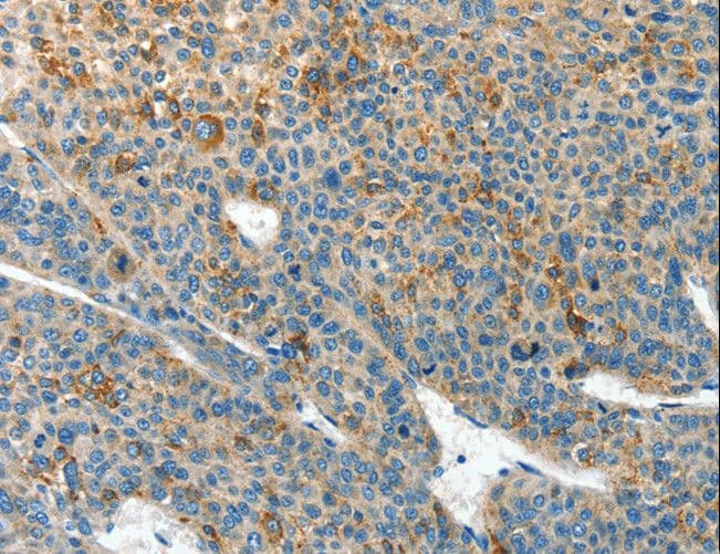 Polyclonal Rabbit anti-Human CLPTM1L / CLPTM1-Like Antibody (IHC)