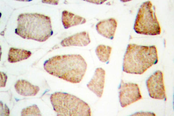 Polyclonal Rabbit anti-Human Actinin-Alpha 2+3 Antibody (Gln58, IHC, IF, WB)