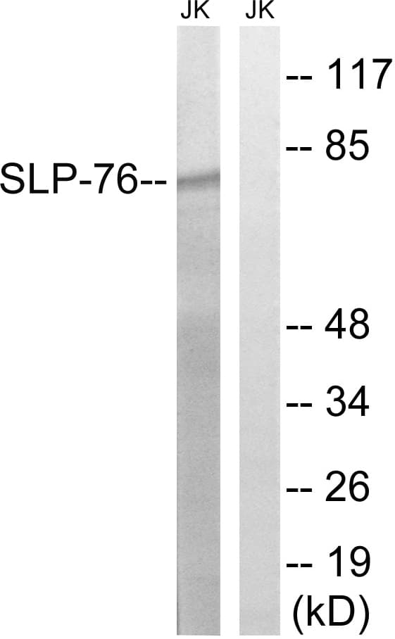 LCP2 / SLP-76 Antibody (aa94-143)