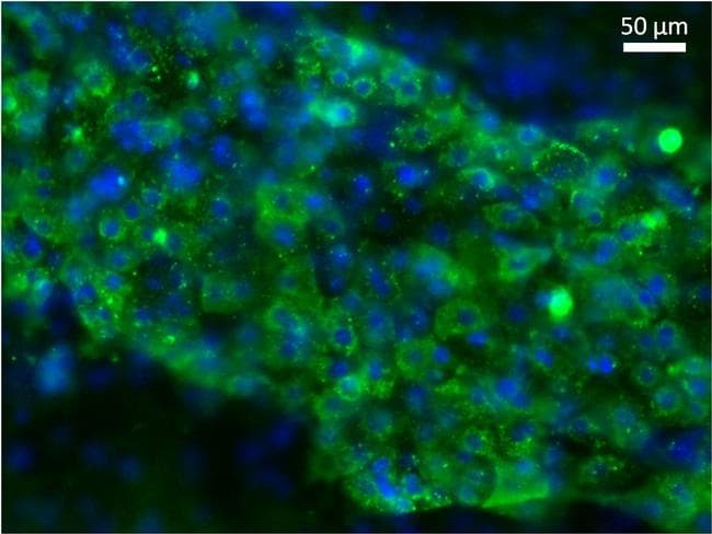Alpha-Fetoprotein Antibody (clone P5B8)