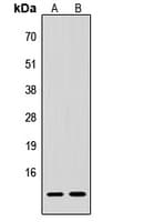 Procalcitonin Antibody (Internal)
