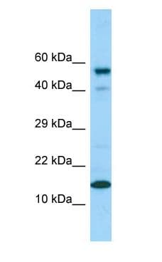 Polyclonal Rabbit anti-Human CDK2AP1 / DOC1 Antibody (C-Terminus, WB)