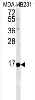 NMB / Neuromedin B Antibody (aa15-42)