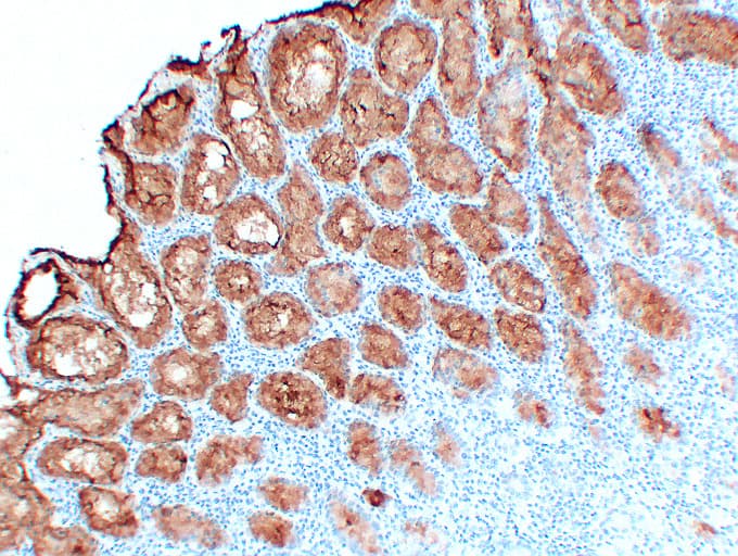 MUC5AC Antibody (clone ABT-MUC5AC)