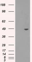 Monoclonal Mouse anti-Human SORD / Sorbitol Dehydrogenase Antibody (clone OTI13G5, IHC, WB)