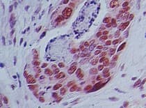 IMPDH2 Antibody (aa221-248)