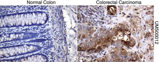 Monoclonal Mouse anti-Human SQSTM1 Antibody (clone UMAB12, Carrier-free, IHC, IF, WB)