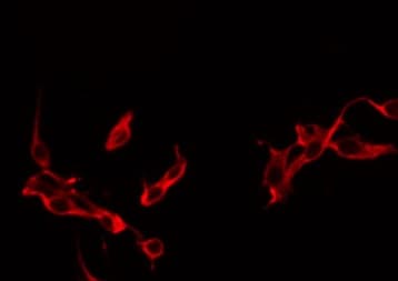 IL21 Antibody