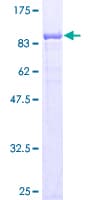 Human CBS Protein (Recombinant GST)