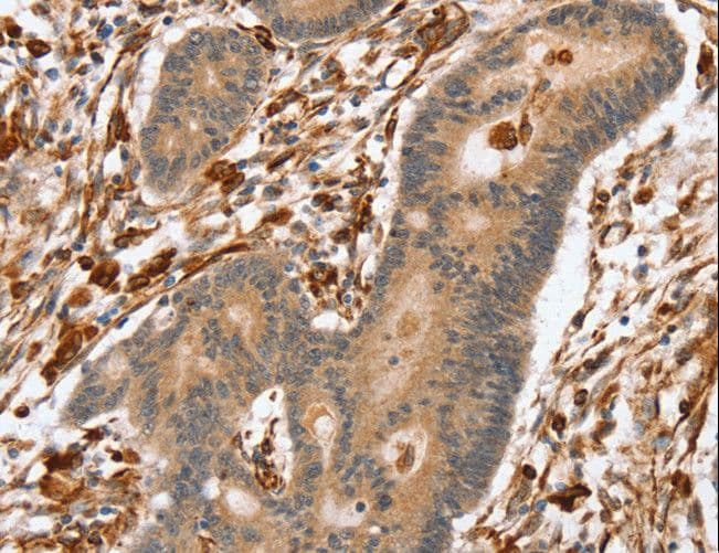Polyclonal Rabbit anti-Human SSX2IP Antibody (IHC, WB)