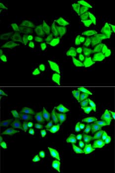 BEST1 / BEST / Bestrophin Antibody