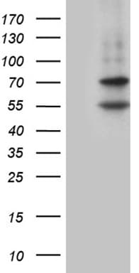 MAK Antibody (aa291-623, clone OTI5A11)