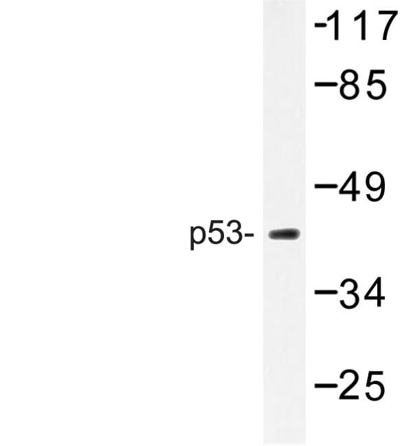 TP53 / p53 Antibody (Leu330)