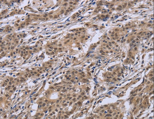 Polyclonal Rabbit anti-Human IPO8 / Importin 8 Antibody (IHC)