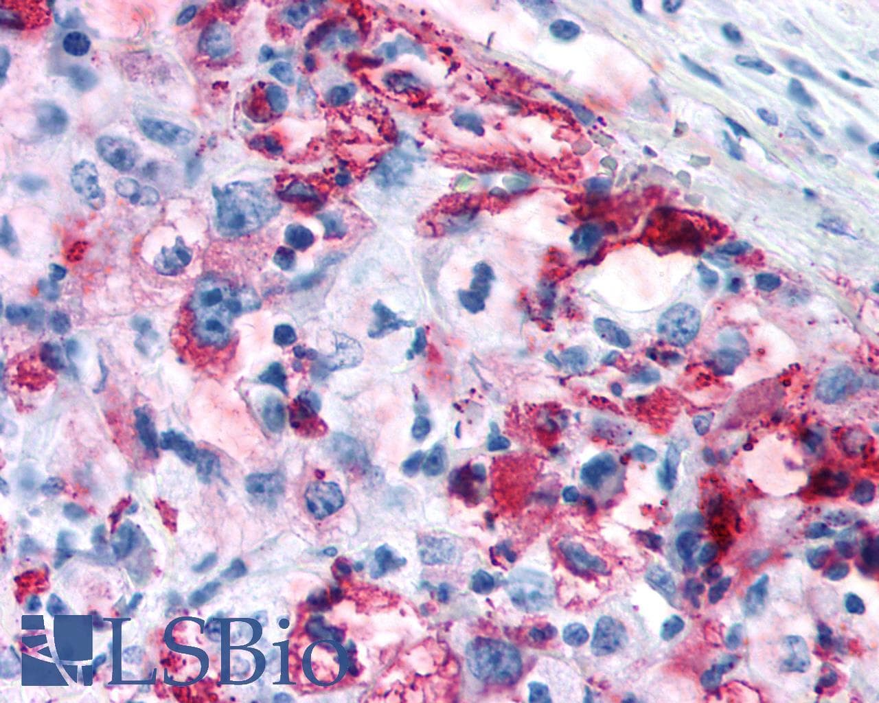 PathPlus™ GPRC5A / RAI3 Antibody (Transmembrane Domain)
