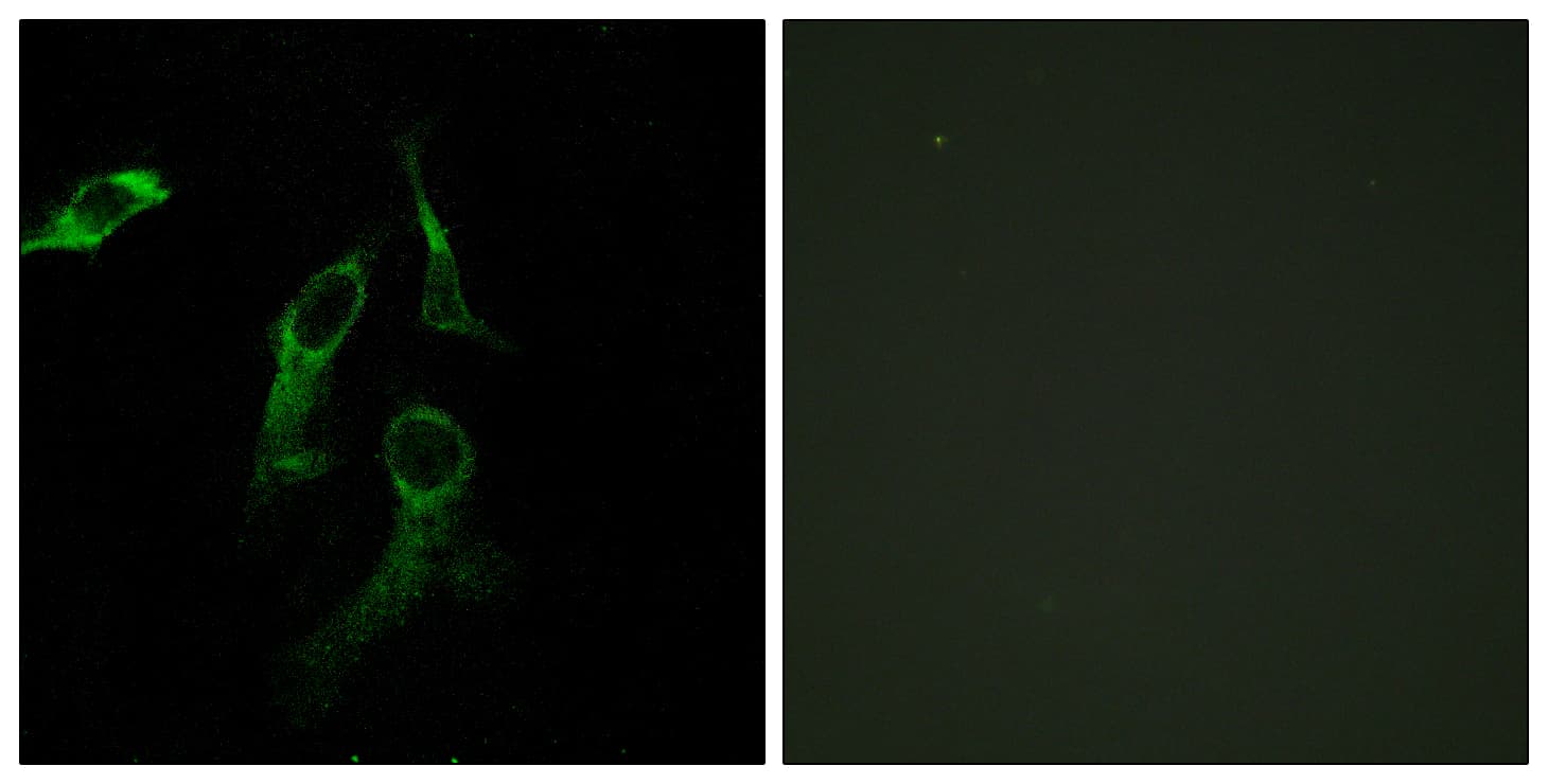 IHC-plus™ Polyclonal Rabbit anti-Human HARS Antibody (aa460-509, IHC, IF, WB)
