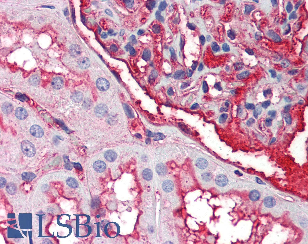 IHC-plus™ Polyclonal Rabbit anti-Human EDA2R / XEDAR Antibody (IHC, WB)