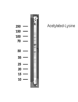 Acetyl-Lysine Antibody