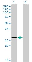 NDUFS3 Antibody (clone 1D6)