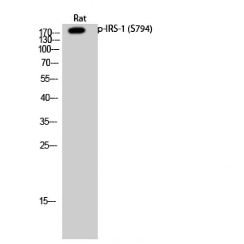 Polyclonal Rabbit anti-Human IRS1 Antibody (730-810 aa, IHC, IF, WB)