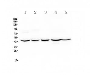 HMBS / PBGD Antibody