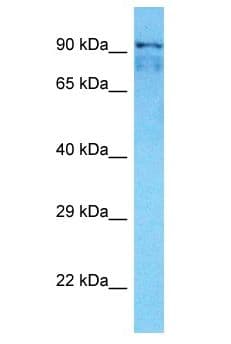 SMARCAL1 Antibody (aa74-123)