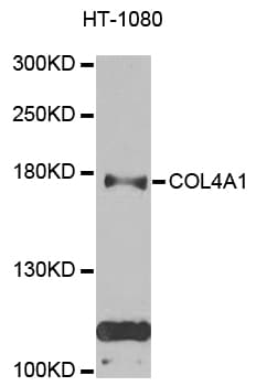 COL4A1 / Collagen IV Alpha1 Antibody